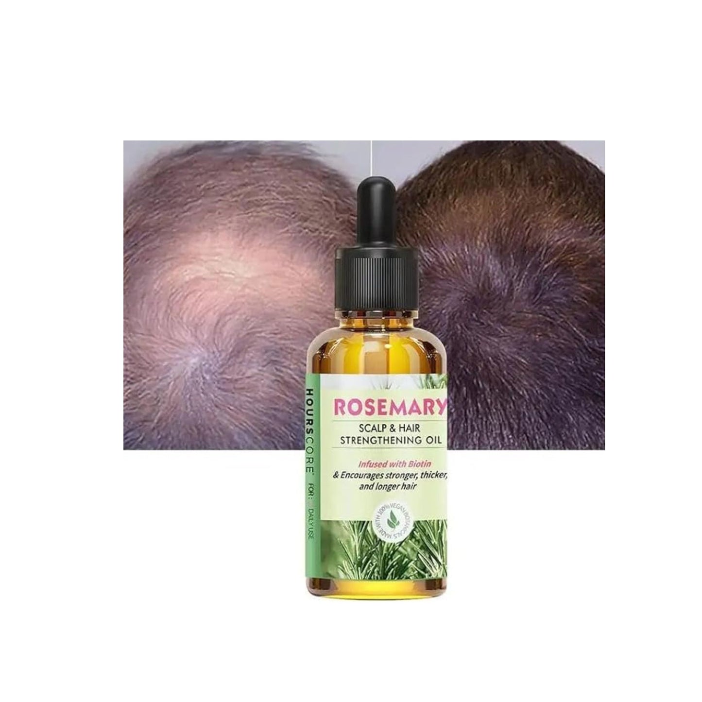 GLOW GENIUS Scalp Strengthening ROSEMARY with NATURAL Essential Oils for Hair and Scalp